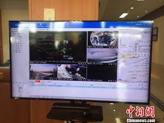 院前急診遠(yuǎn)程監(jiān)控?！≈煲?攝